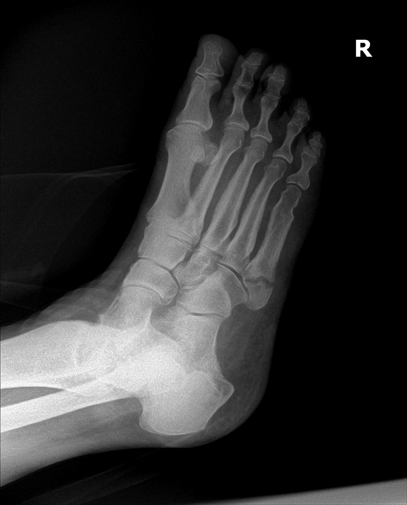 Scott T. Grodman, DPM | Pediatric Foot Care, Plantar Fasciitis and Bunions