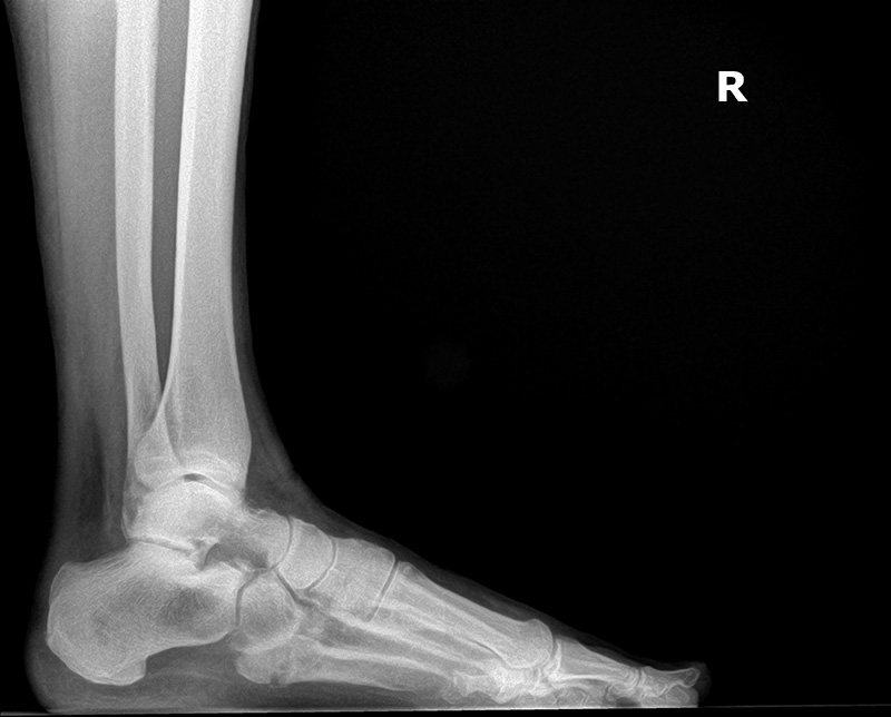 Scott T. Grodman, DPM | Geriatric Foot Care, Orthotics and Sports Injuries