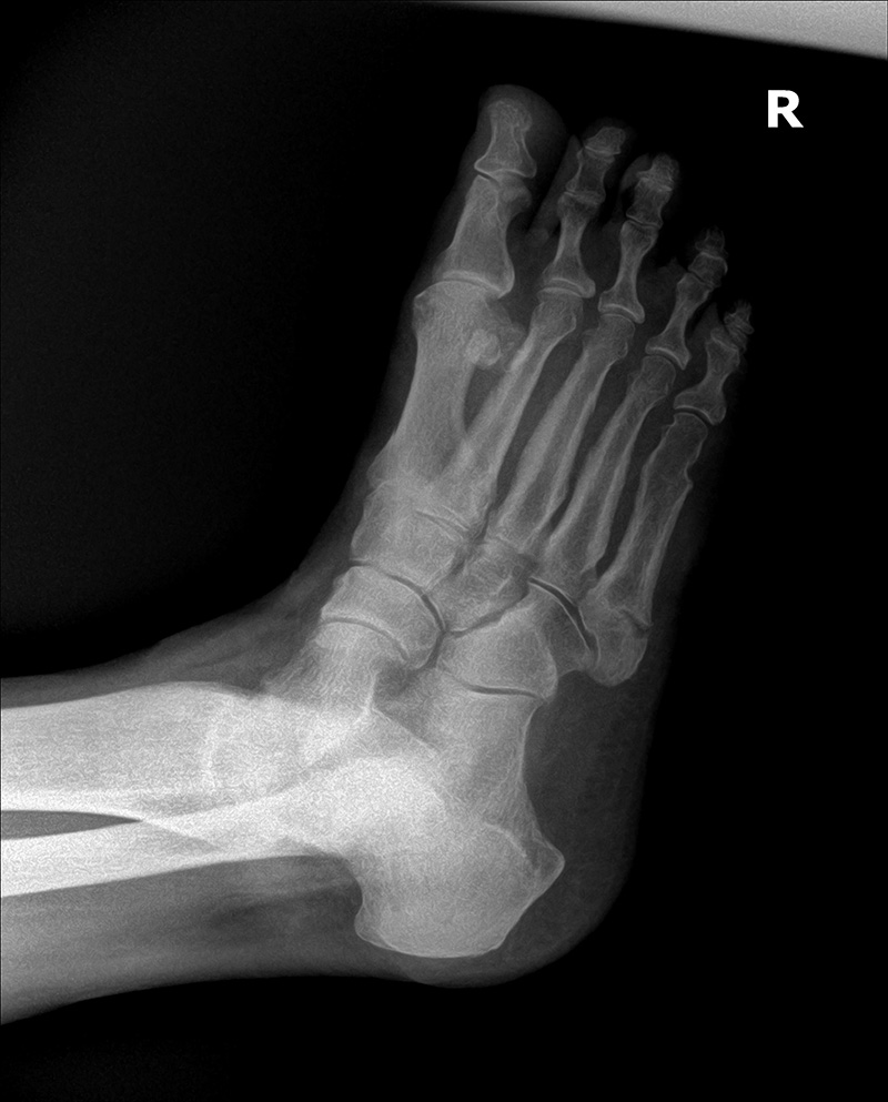 Scott T. Grodman, DPM | Heel Pain Shockwave, Orthotics and Skin Disorder